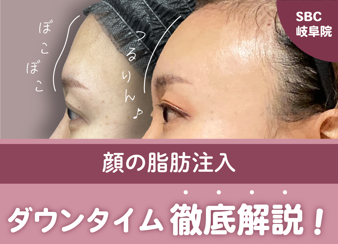 顔の脂肪注入ダウンタイム徹底解説